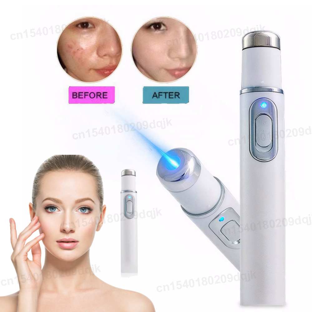 Terapia della luce blu Penna p - Acne Light Therapy Pen recensione e prezzo